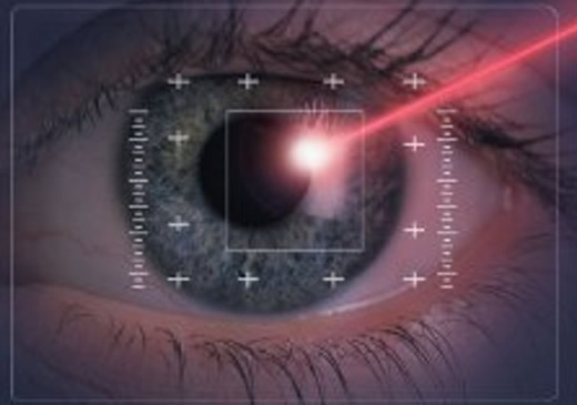 Прогрессивное восстановление зрения: лазерная коррекция