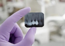 Почему для стоматологов важны рентгеновские снимки?
