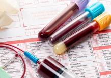 Как правильно подготовиться к анализу крови: советы врача