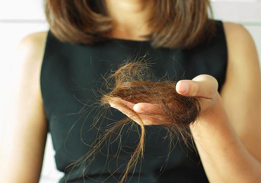 Какие анализы нужно сдать, если выпадают волосы?