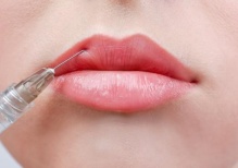 Естественное увеличение объема губ: секреты уколов красоты с использованием филлеров
